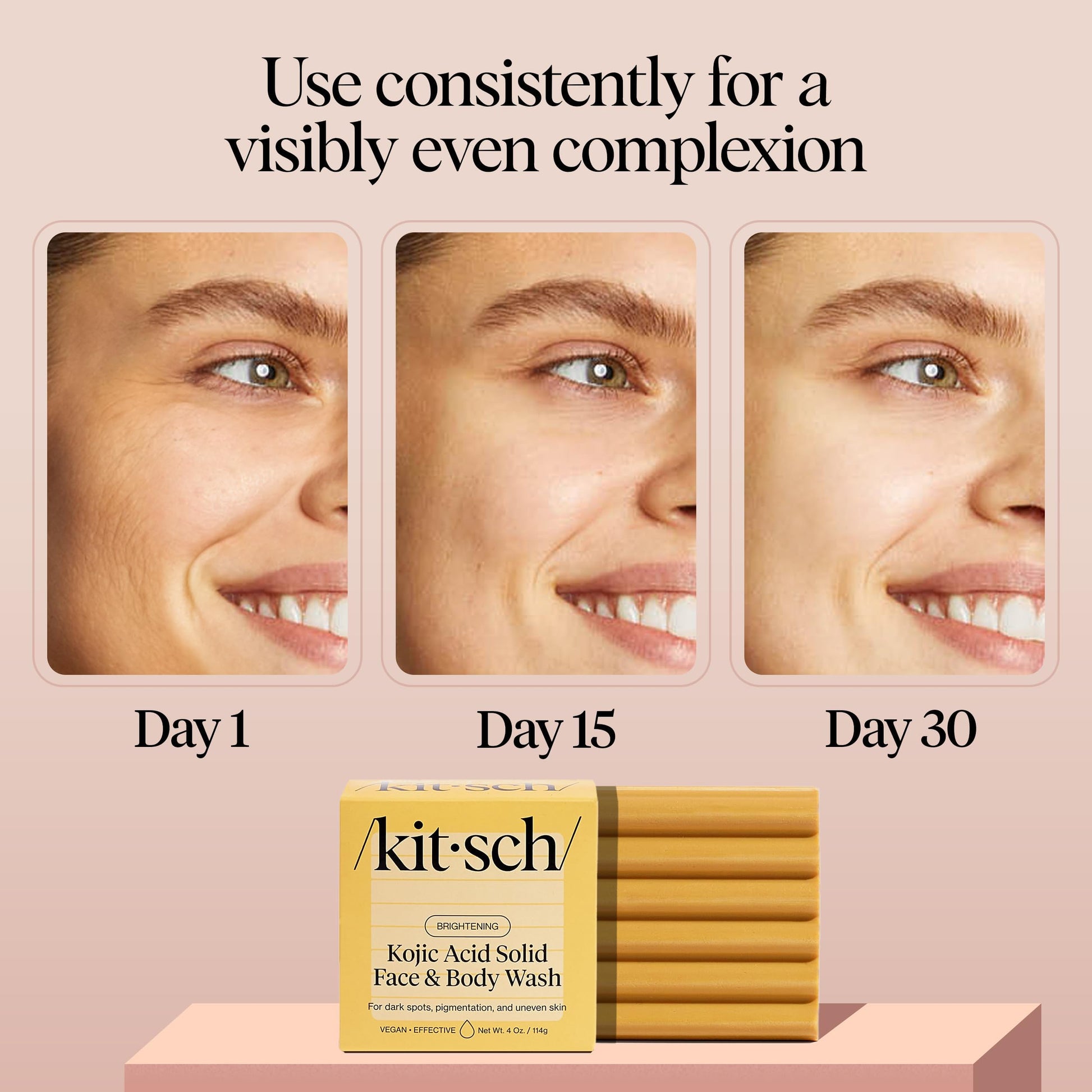 Kitsch Kojic Acid Soap – Turmeric Soap Bar with Hyaluronic Acid & Shea Butter – Brightening & Hydrating Body Wash & Face Wash for Dark Spots Kitsch buy supplements canada