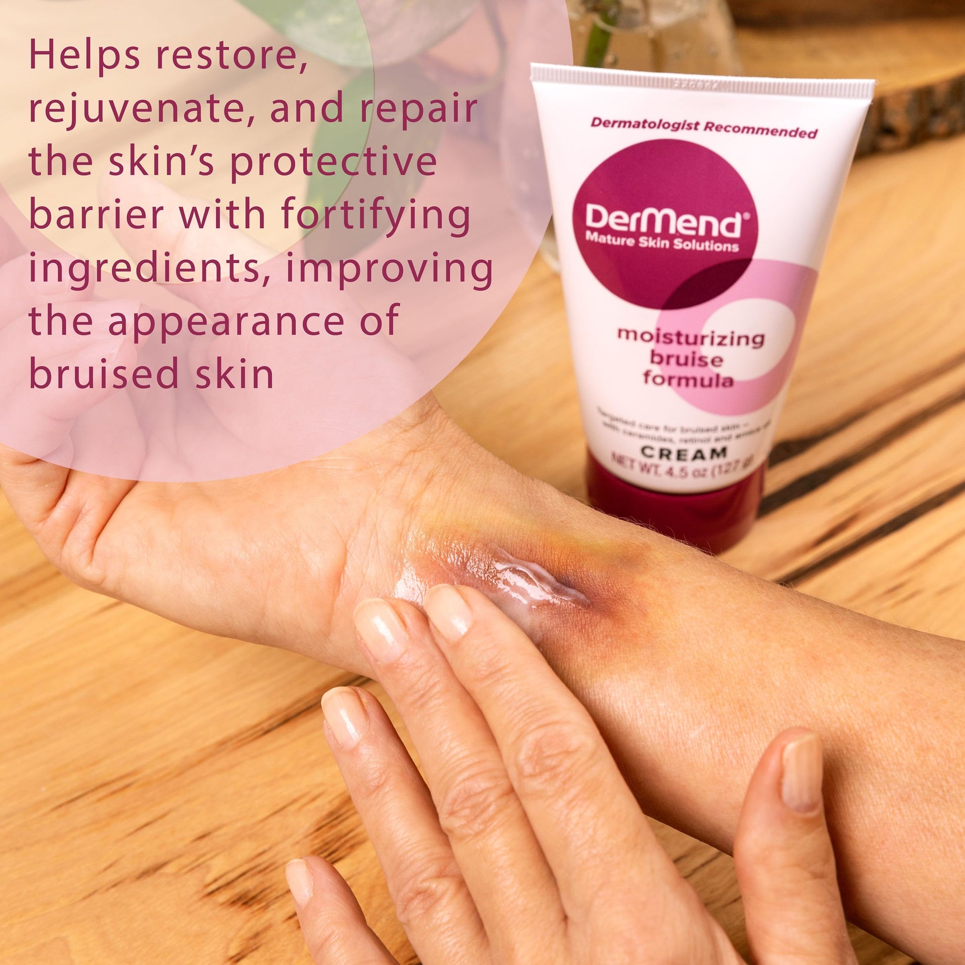Dermend Arnica Bruise Cream with Vitamin K - Moisturizer for Bruising on Arms, Legs & Hands - 4.5 Oz Dermend buy supplements canada