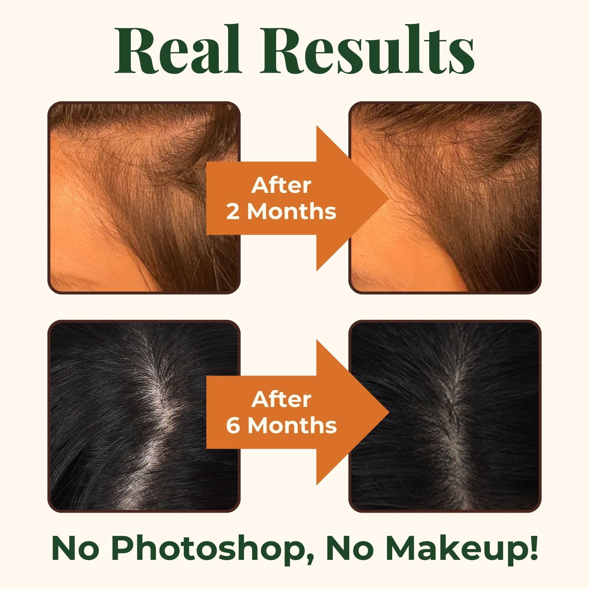 Heebin's Royal Hair, Brows & Lashes, Hair Growth Vitamins with Biotin 4000 mcg, Collagen Heebin's buy supplements canada