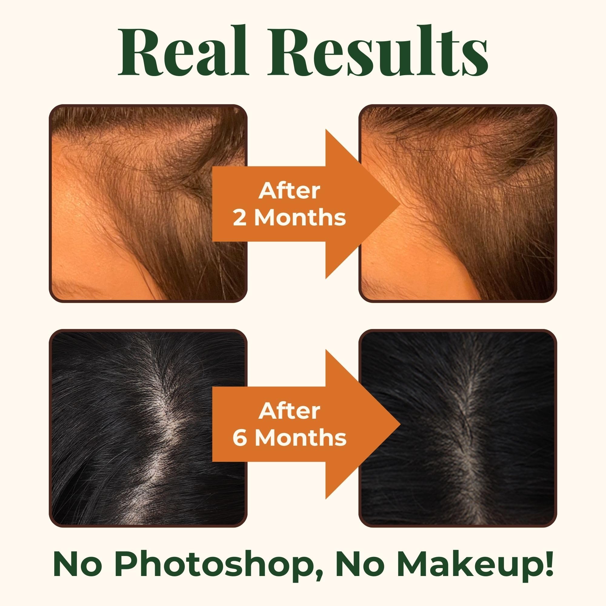 Heebin's Royal Hair, Brows & Lashes, Hair Growth Vitamins with Biotin 4000 mcg, Collagen Heebin's buy supplements canada