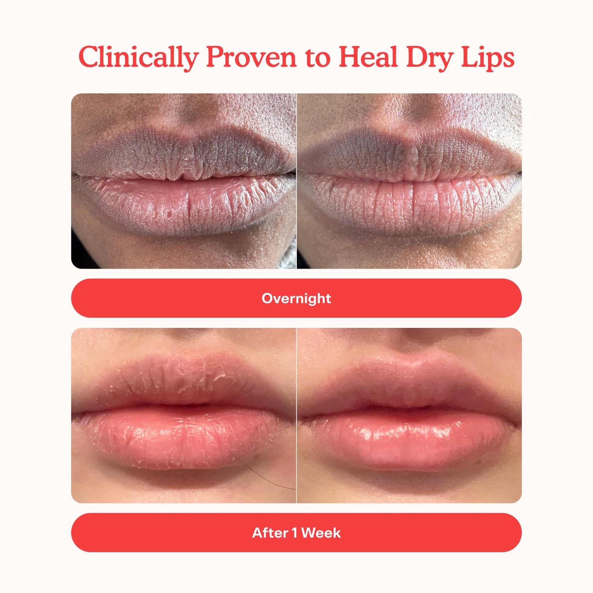Tower 28 LipSoftie Tinted Lip Balm Treatment - Hydrating Glossy Balm + Overnight Lip Mask with Jojoba Oil + Shea Butter - Sweet Tower 28 buy supplements canada