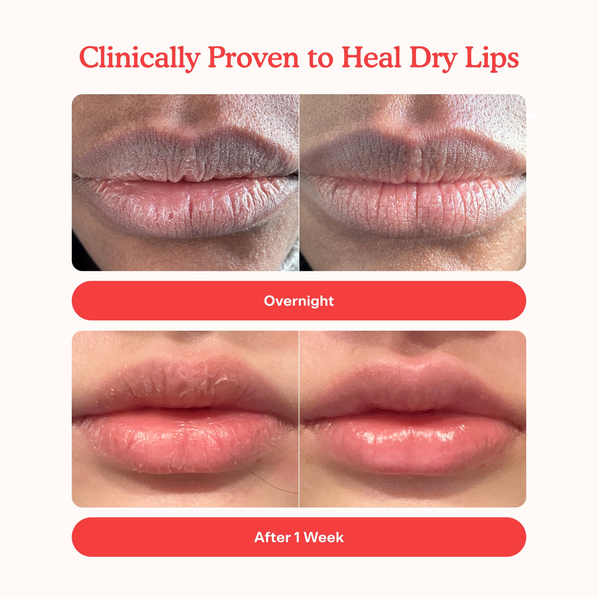 Tower 28 LipSoftie Tinted Lip Balm Treatment - Hydrating Glossy Balm + Overnight Lip Mask with Jojoba Oil + Shea Butter - Sweet Tower 28 buy supplements canada