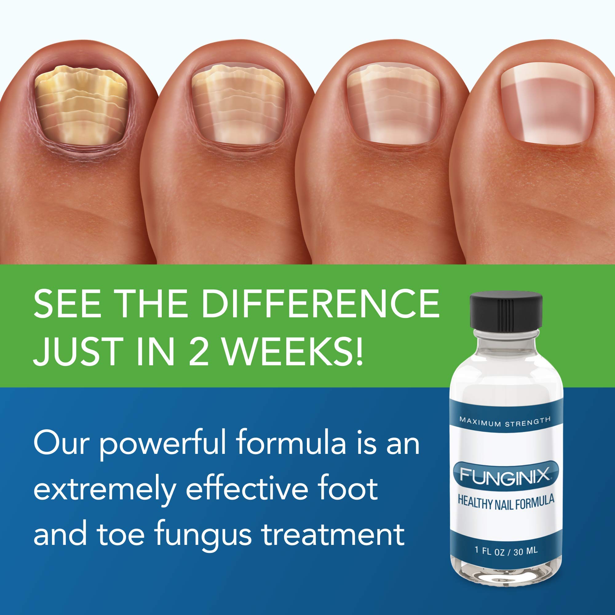 FUNGINIX Healthy Nail Formula - Finger And Toe Fungus Treatment, Made In USA, Foot FUNGINIX buy supplements canada
