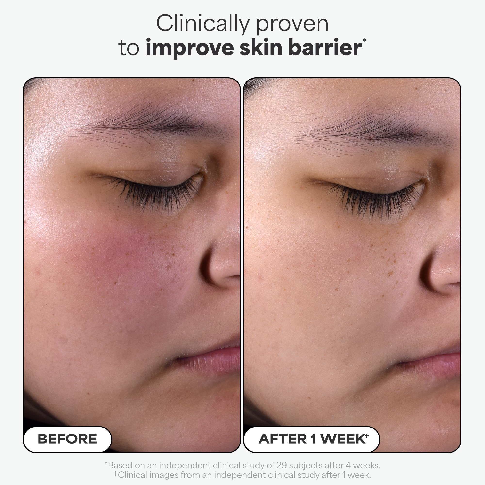 Paulas Choice--SKIN PERFECTING 2% BHA Liquid Salicylic Acid Exfoliant--Facial Exfoliant for Blackheads, Enlarged Pores, Wrinkles & Fine Lines, 4 oz Bottle Paula's Choice buy supplements canada