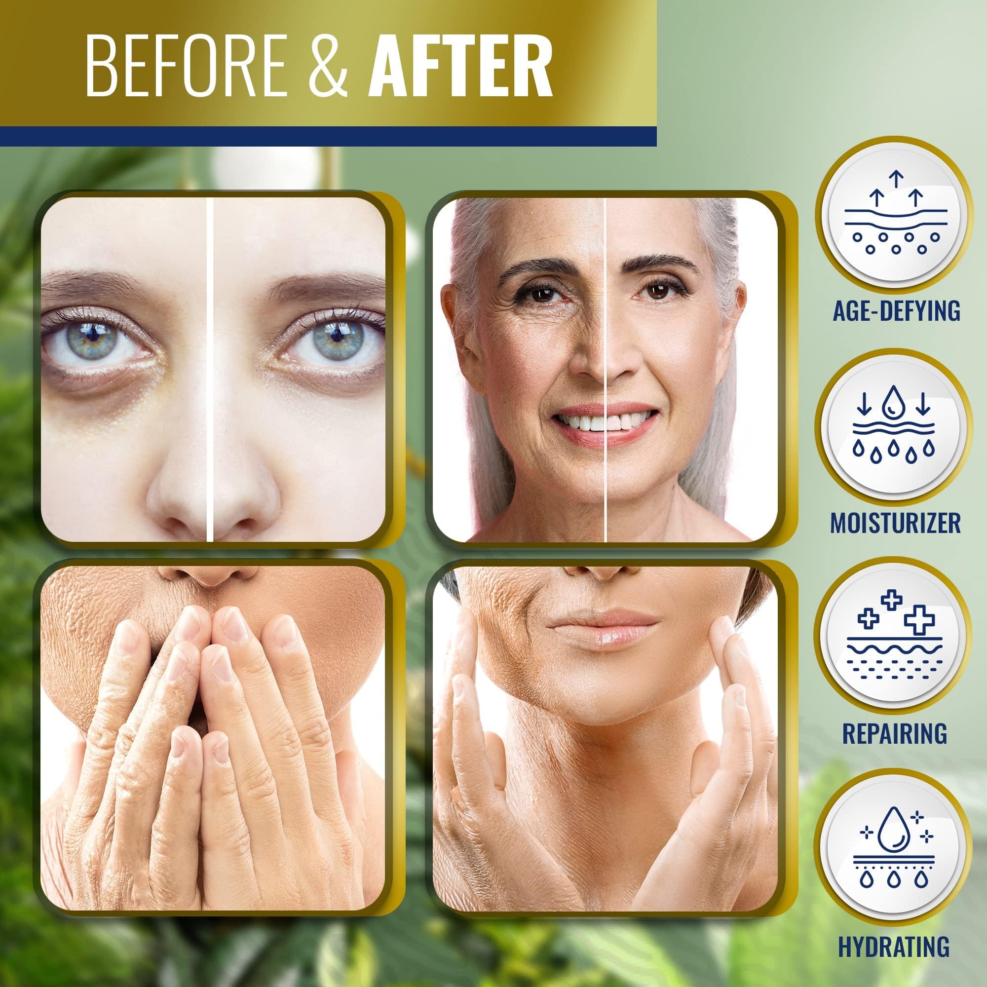 Advanced Clinicals Retinol Body Butter Lotion Moisturizer Face Lotion & Body Cream Advanced Clinicals buy supplements canada