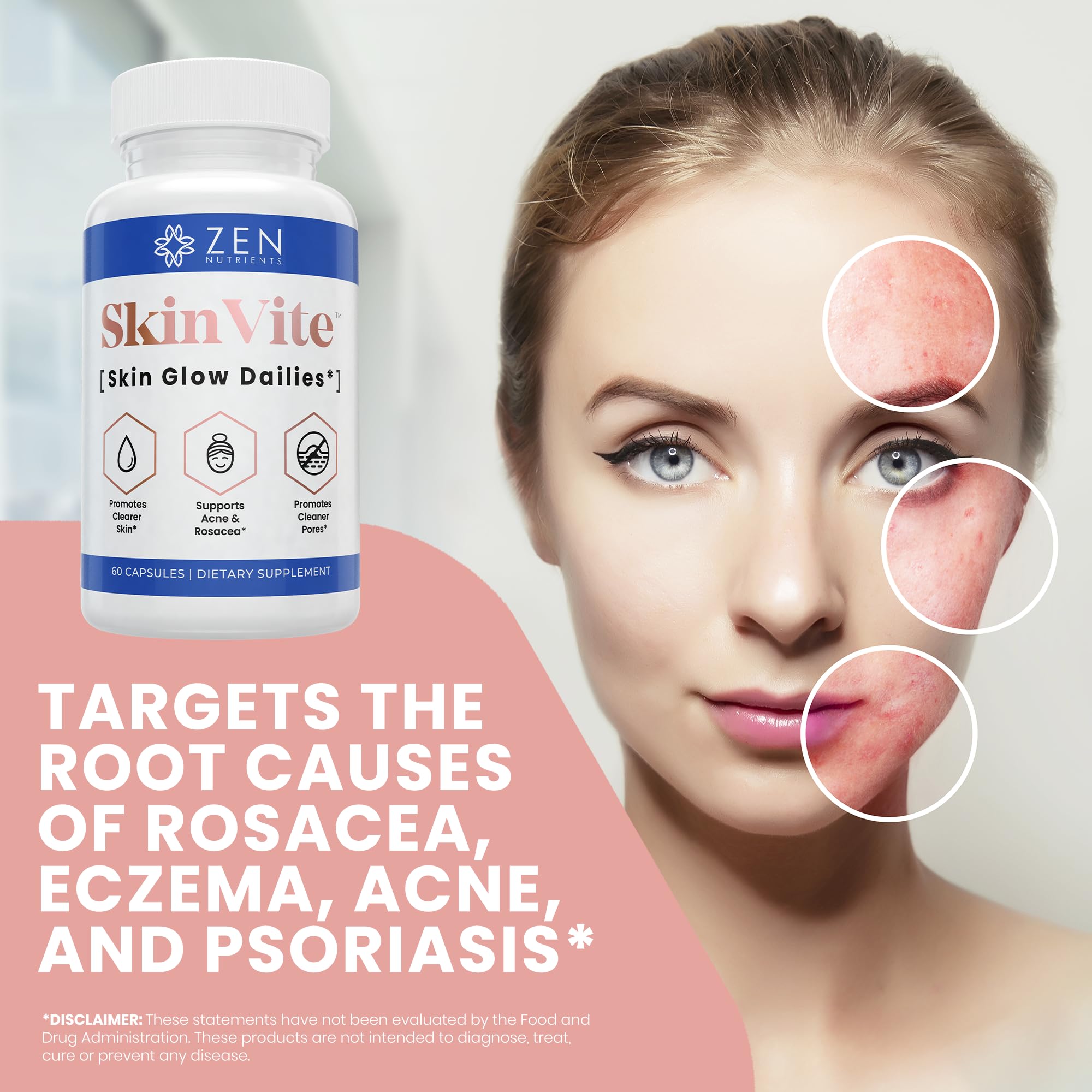Zen Nutrients SkinVite Natural Skin Supplement for Women, Men & Teens - Hormonal Breakouts & Clear Skin Support Supplement - Detoxifying Vitamin for Acne and Digestion Support Zen Nutrients buy supplements canada
