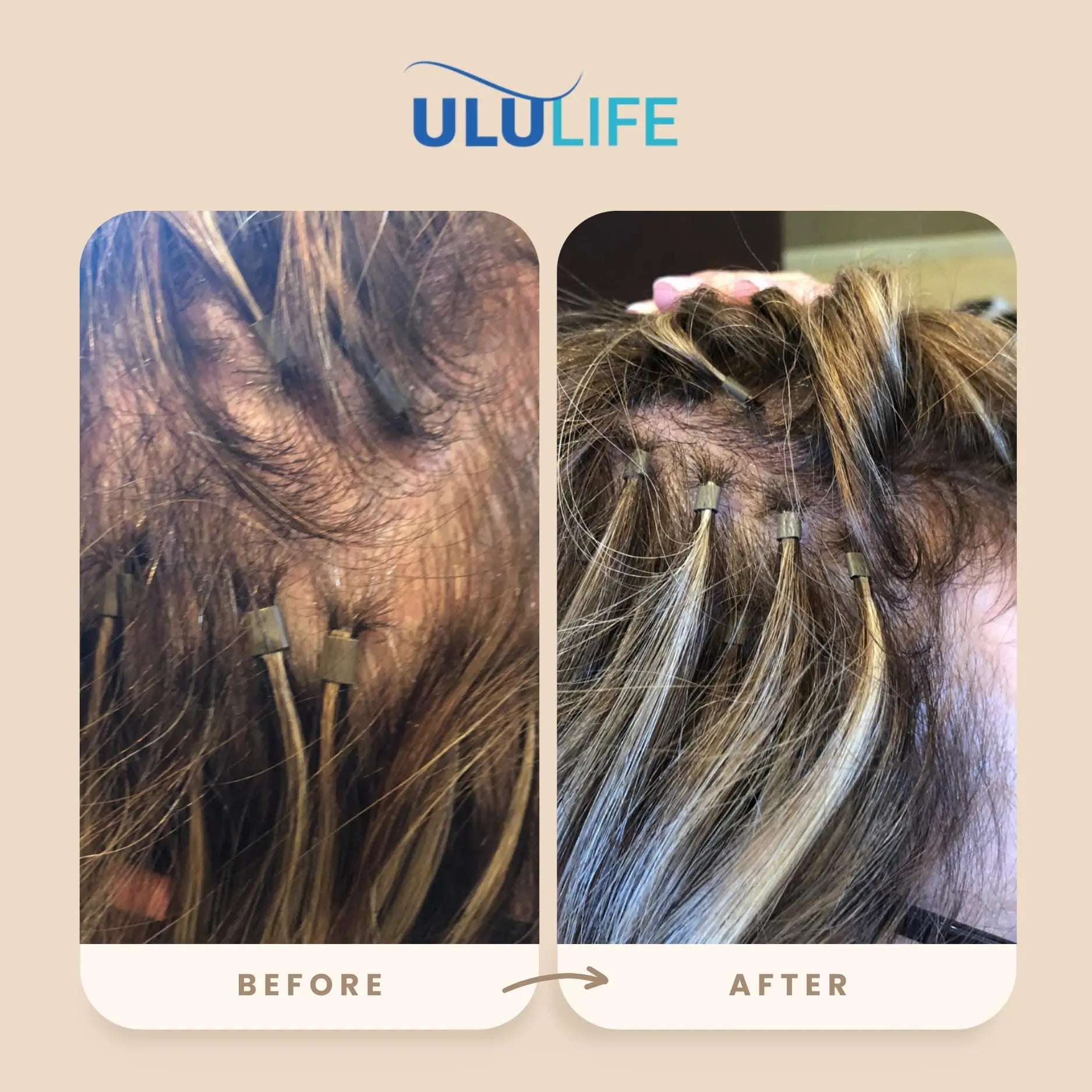 ULULIFE Complete Multivitamin for Men & Women: All-Natural & Cruelty Free with Biotin, Collagen, Keratin, & More - Promotes Hair Growth & Thickness ULULIFE buy supplements canada