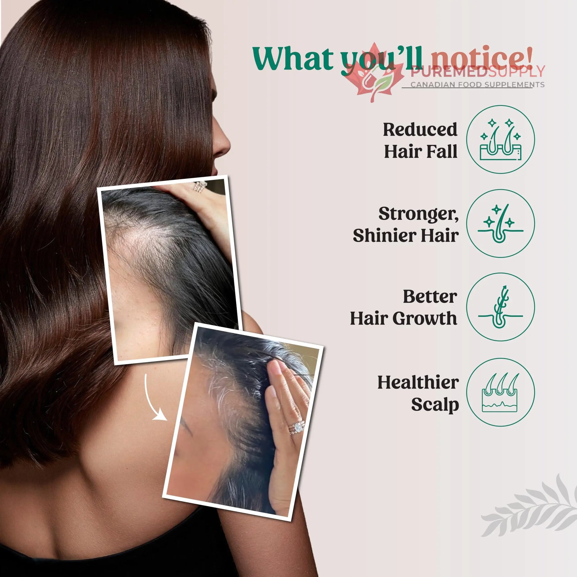 Glosense Hair You Glo – Plant-Based Biotin Supplement | Hair Growth Drink | Natural Hair Vitamins Powder with Amla, Sea Buckthorn, Gotu Kola | No Added Sugar, No Added Flavours | 30 Servings Glosense buy supplements canada