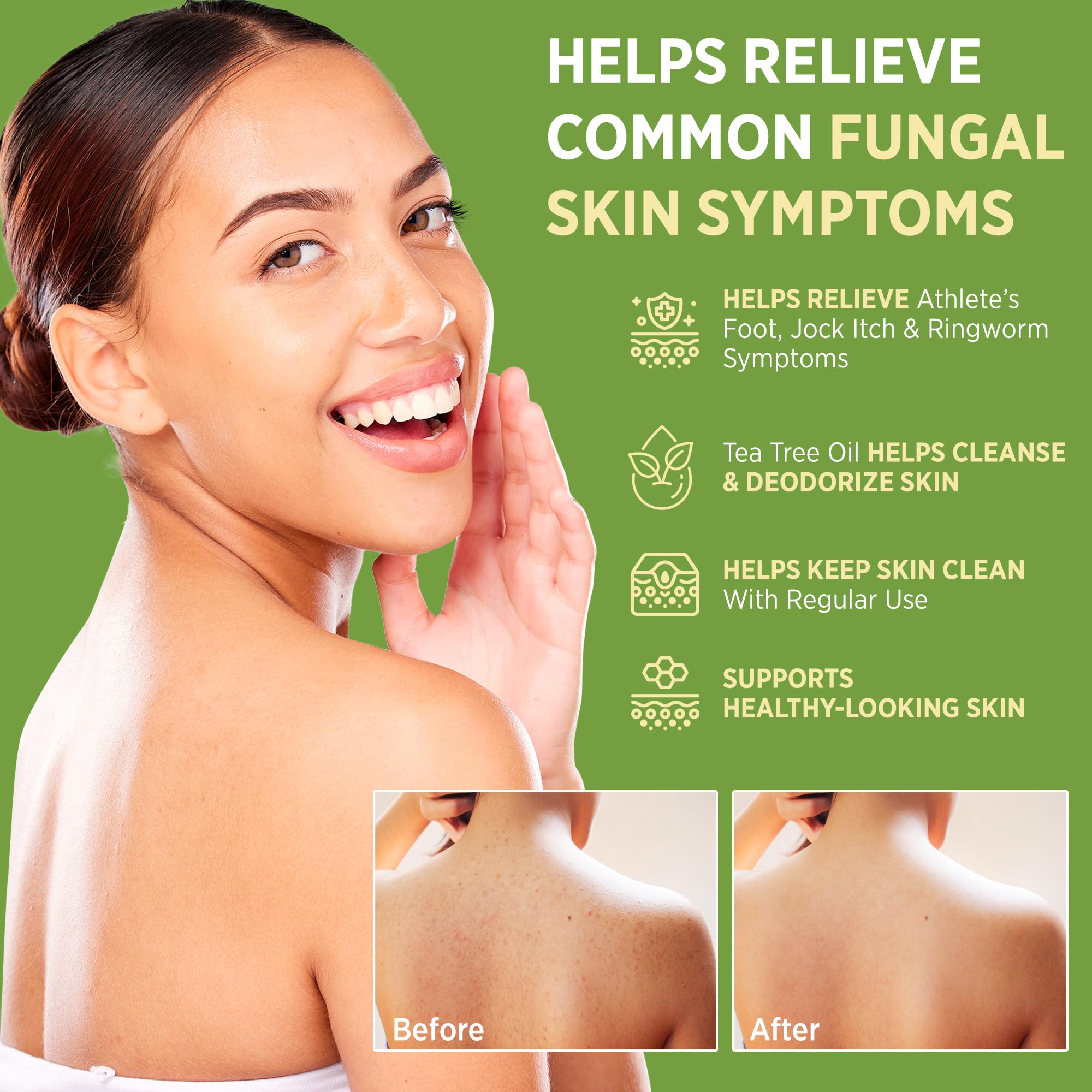 Roycederm Antifungal Bar Soap - Tea tree Oil Soap - Athlete’s Foot Treatment for Jock Itch & Ringworm Roycederm buy supplements canada