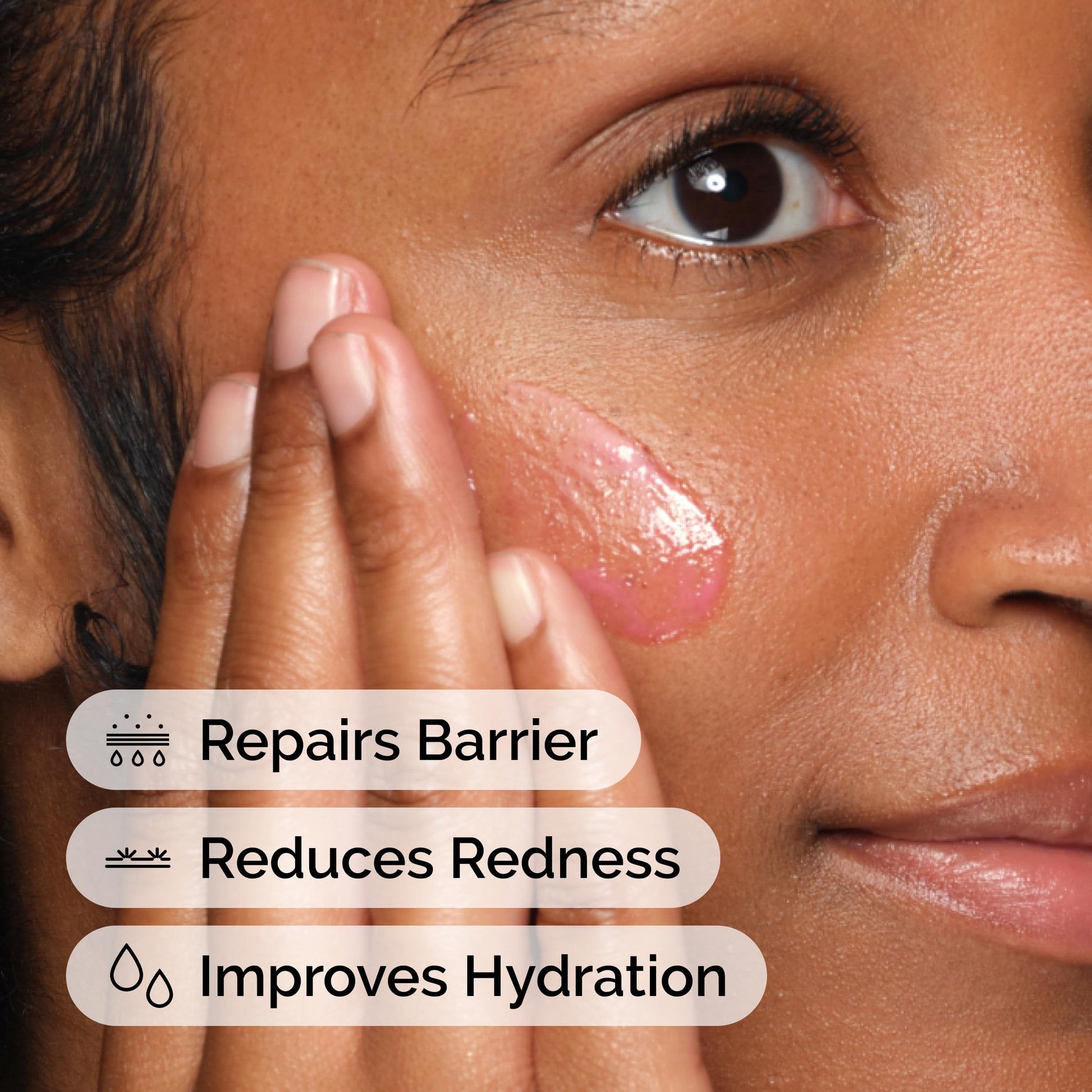 The Ordinary Soothing & Barrier Support Serum, Redness-Reducing & Hydrating Solution for Skin Barrier Recovery, 1 Fl Oz The Ordinary buy supplements canada