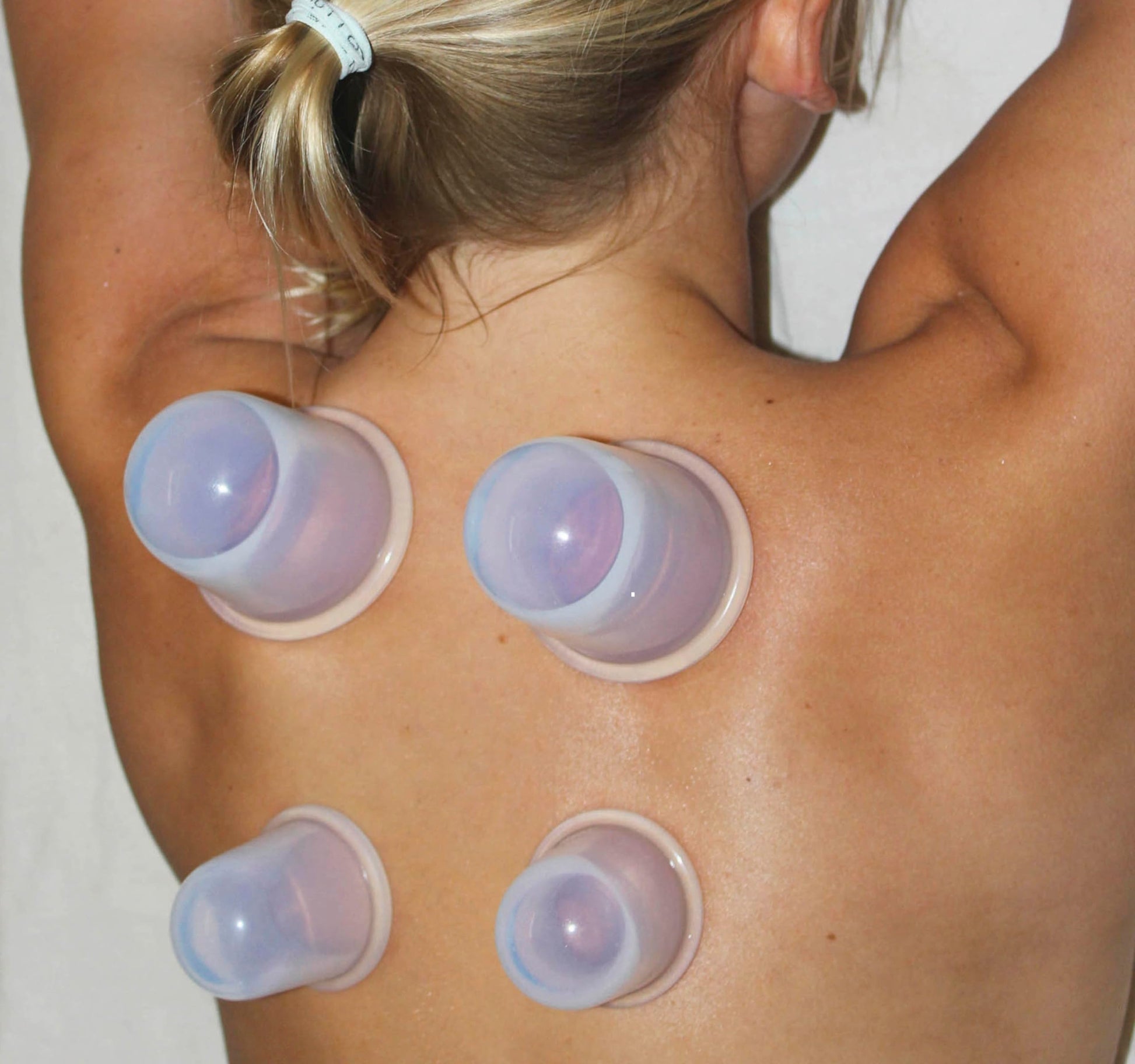 Cupping Kit for Massage Therapy - by DoSensePro, Cupping Set of 6 Professional Silicone Cups DoSensePro buy supplements canada