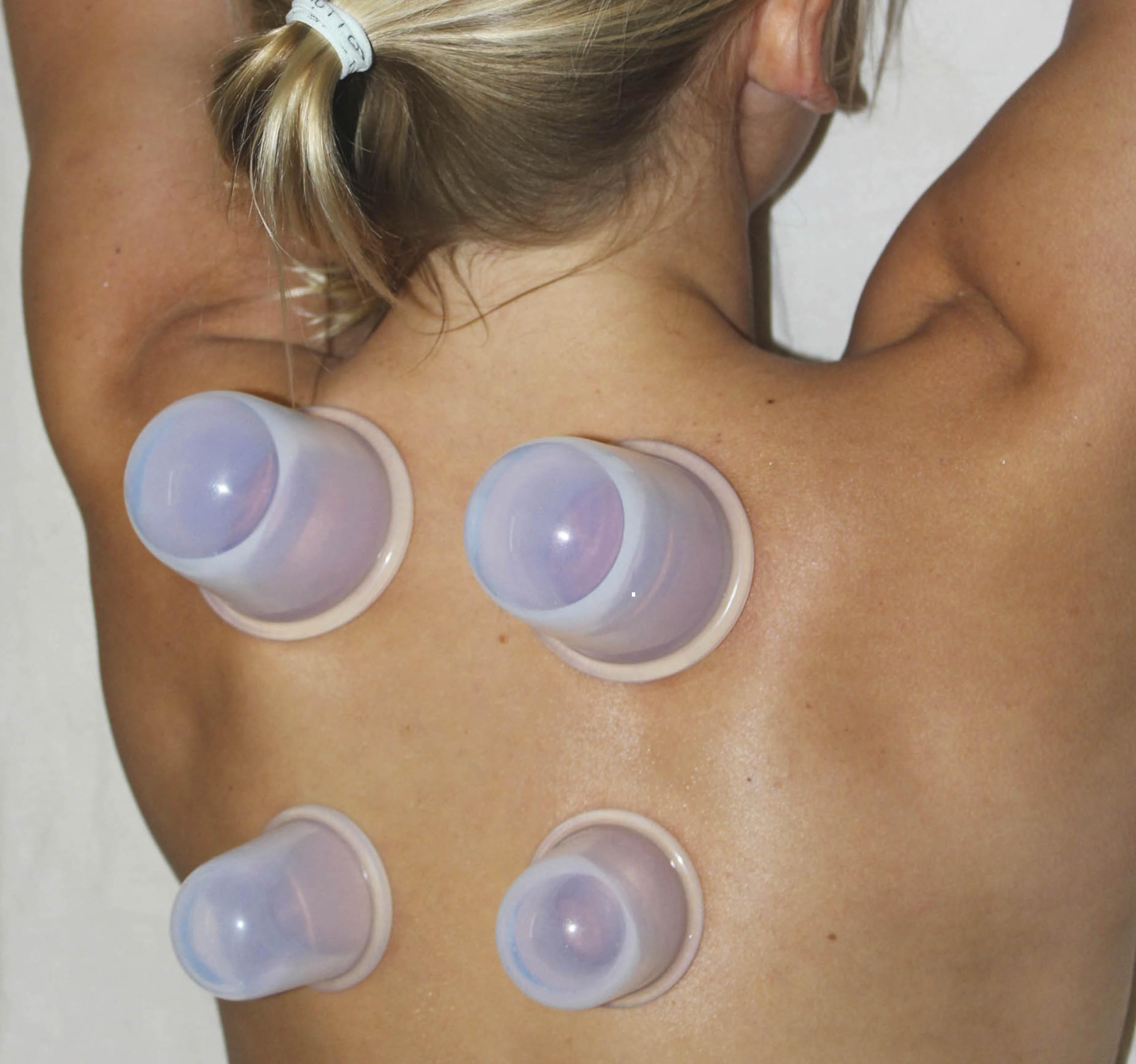 Cupping Kit for Massage Therapy - by DoSensePro, Cupping Set of 6 Professional Silicone Cups DoSensePro buy supplements canada