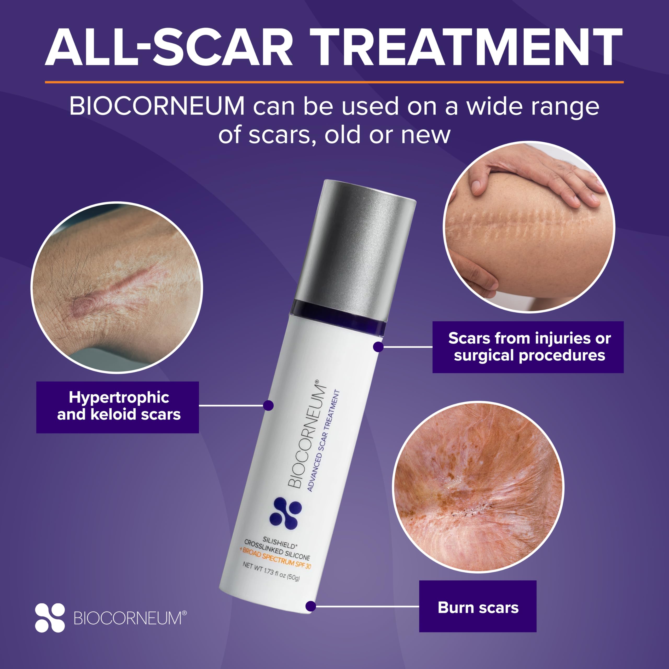 Biocorneum Advanced Scar Treatment with Silishield® & SPF 30 10g – Medical Grade Silicone Gel to Support Healing of Surgical Scars and Marks BIOCORNEUM buy supplements canada