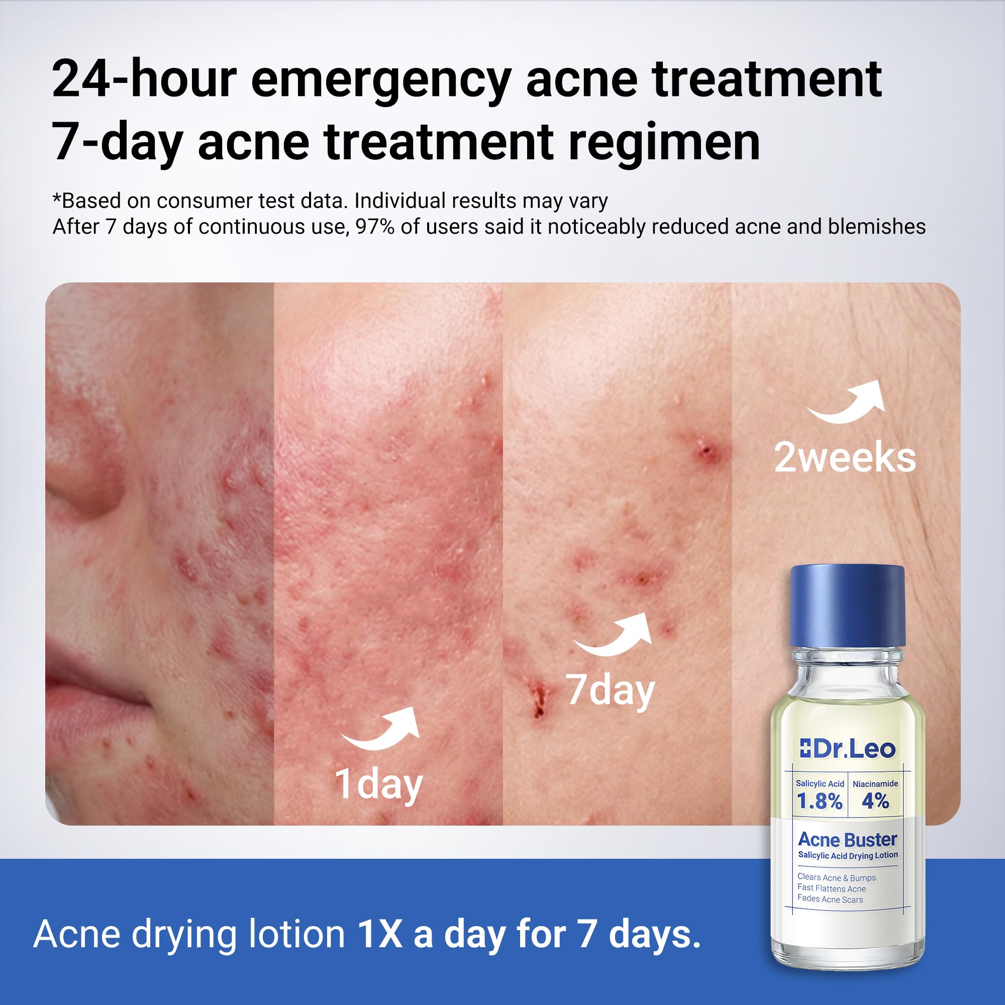 Dr.Leo 1.8% Salicylic Acid Spot Serum, Acne Treatment for Acne-Prone Sensitive Skin | Niacinamide, Fast Pimple Relief, Fades Acne Marks Dr.Leo buy supplements canada