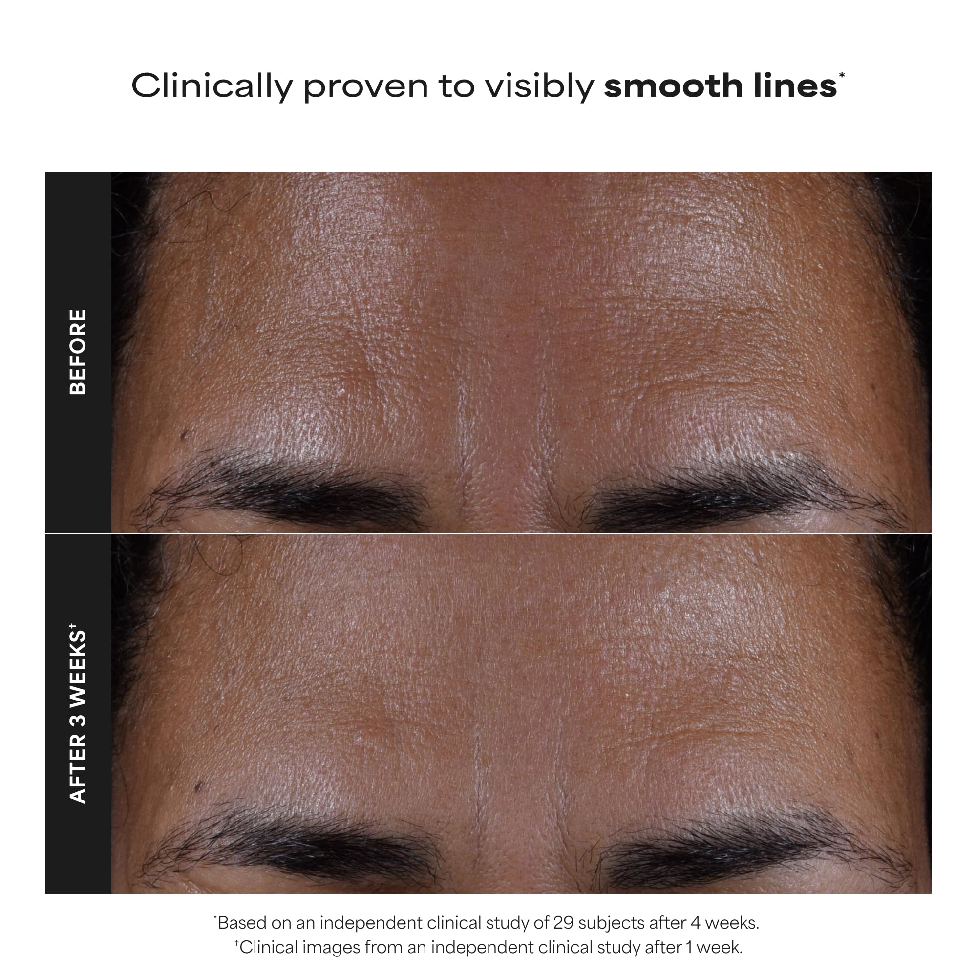 Paulas Choice--SKIN PERFECTING 2% BHA Liquid Salicylic Acid Exfoliant--Facial Exfoliant Paula's Choice buy supplements canada