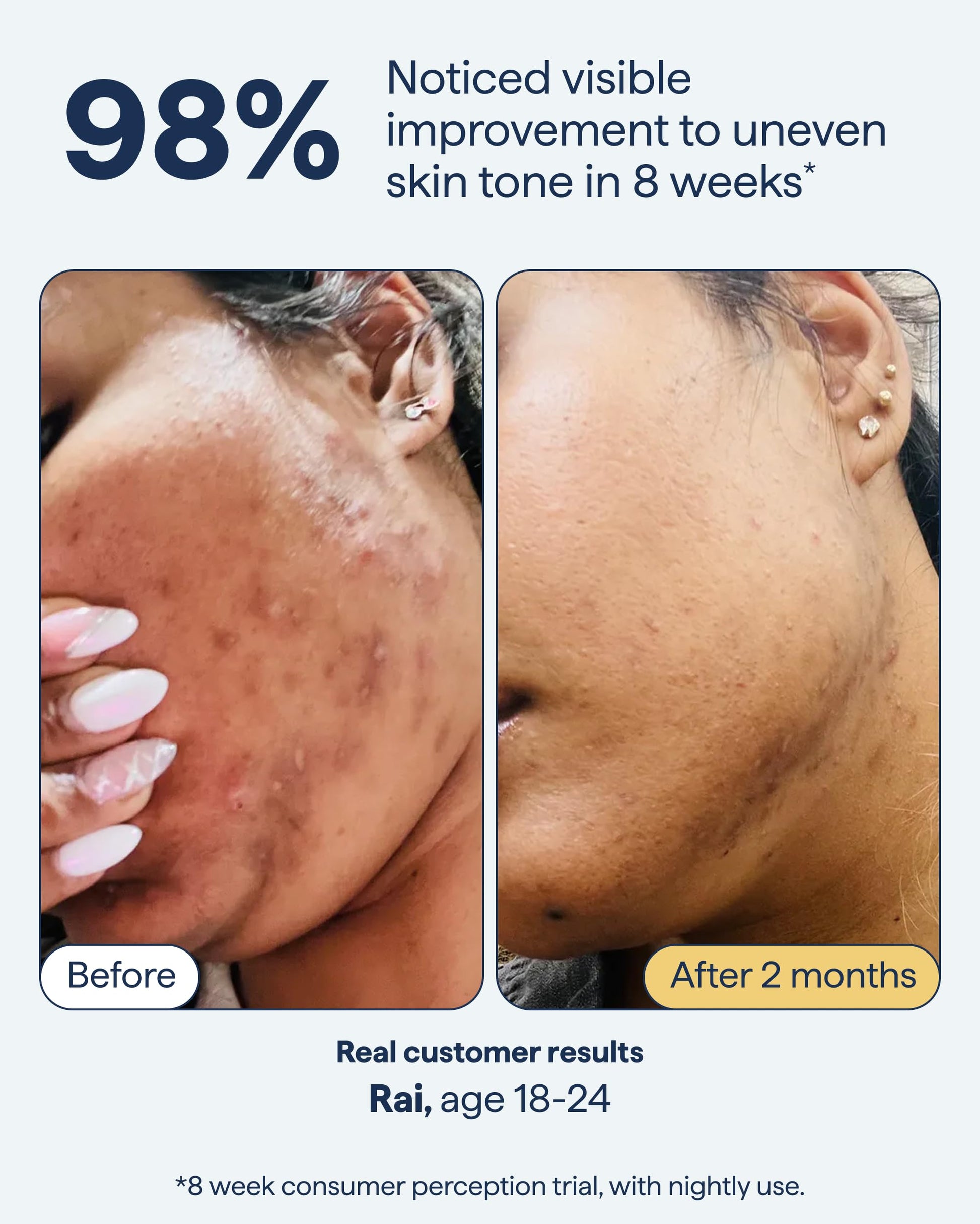 Remedy for Dark Spots | Advanced Night Treatment with Retinol & Kojic Acid | For Discoloration and Uneven Tones | With Glutathione Remedy Science buy supplements canada