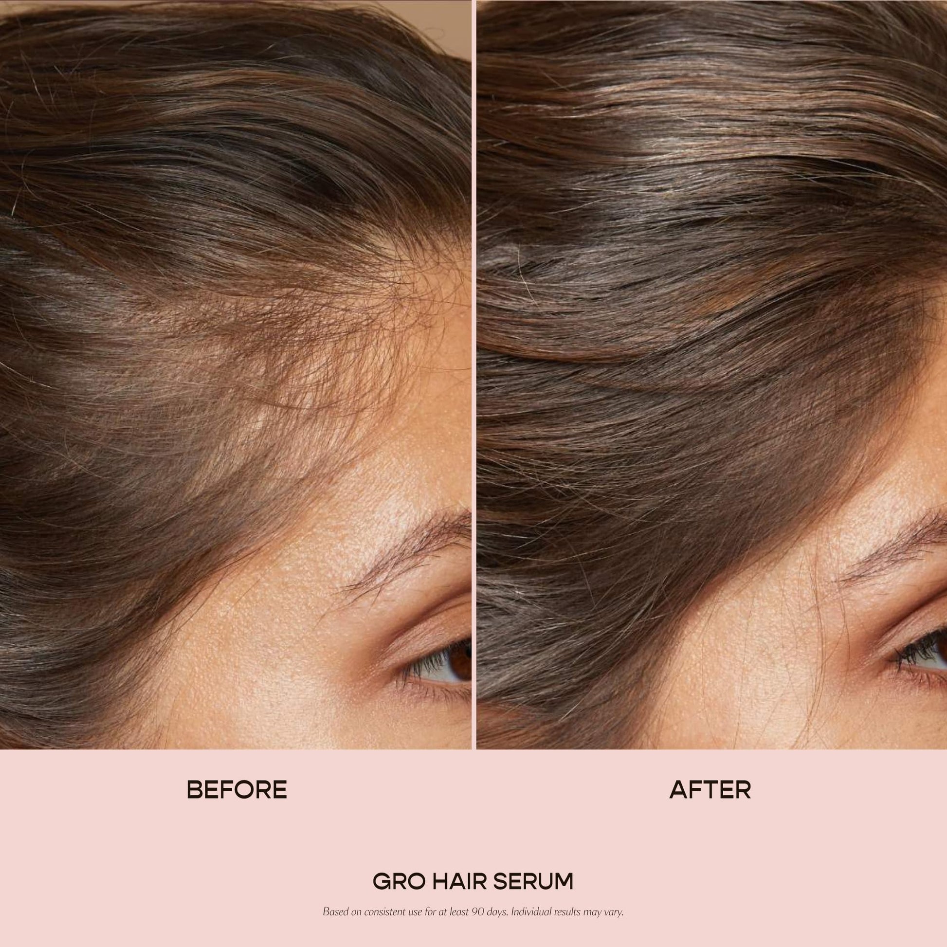VEGAMOUR GRO Hair Serum for Hair Thinning, Thicker Fuller Looking Hair, Non Oily Tonic for Healthier Scalp, 30 day Supply 1.0 fl oz, 1 pack VEGAMOUR buy supplements canada