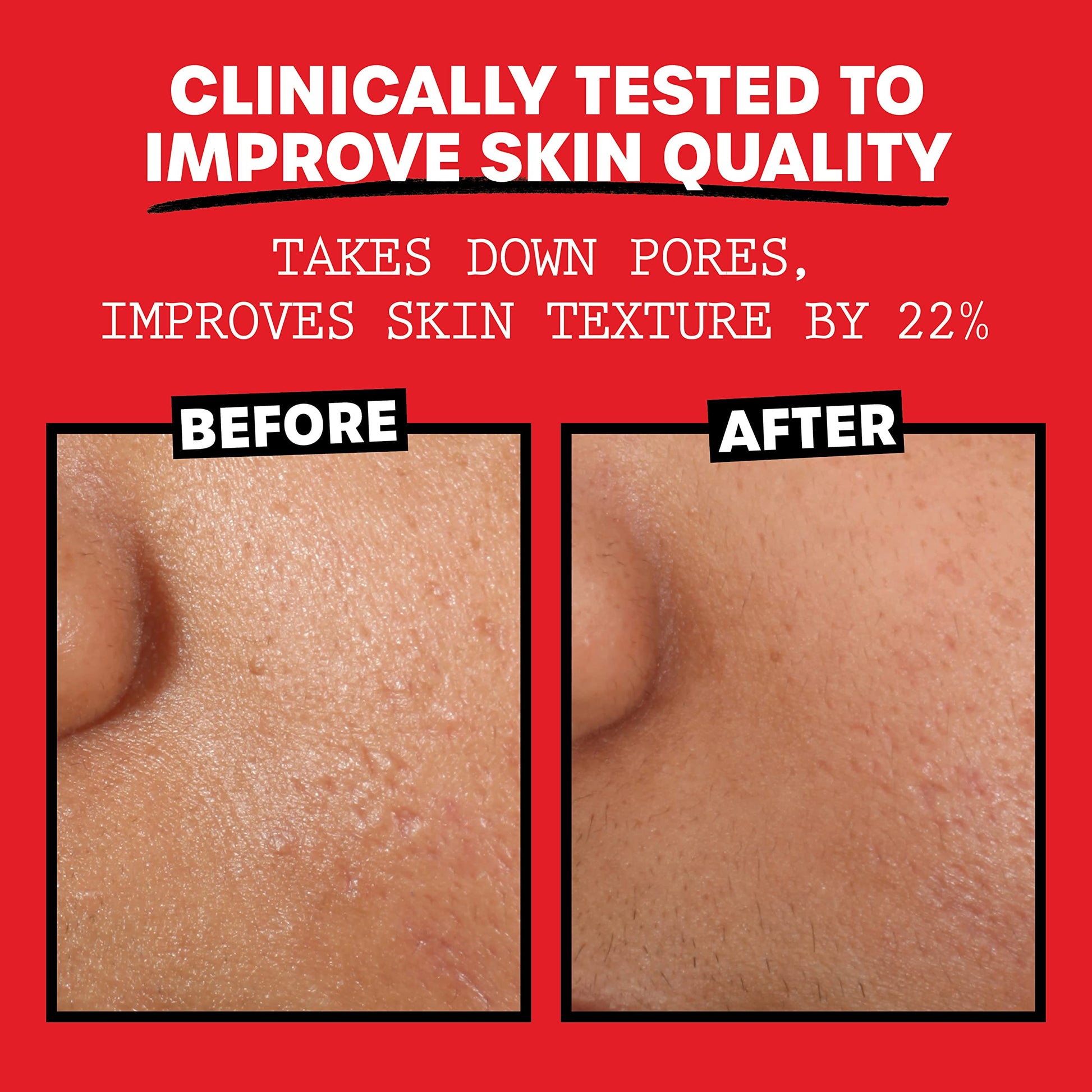Thayers Alcohol-Free, Hydrating Rose Petal Witch Hazel Facial Toner 12 oz + 3oz THAYERS buy supplements canada