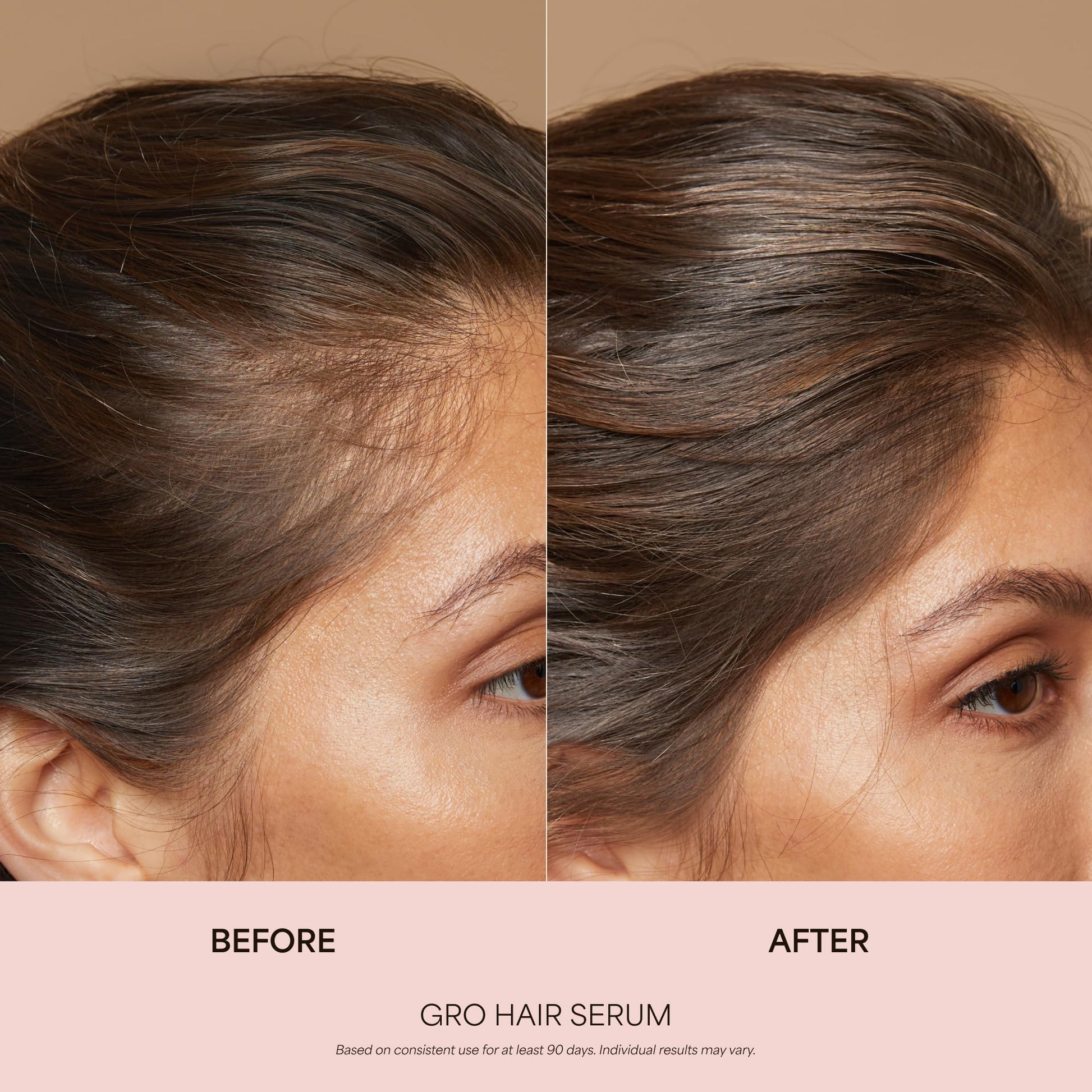 VEGAMOUR GRO Healthy Hair Starter Kit | Full Size GRO Serum for Thinning & Shedding plus Travel Size Shampoo and Conditioner with Vegan Keratin to Support Thicker, Fuller Looking Locks | $92 Value VEGAMOUR buy supplements canada