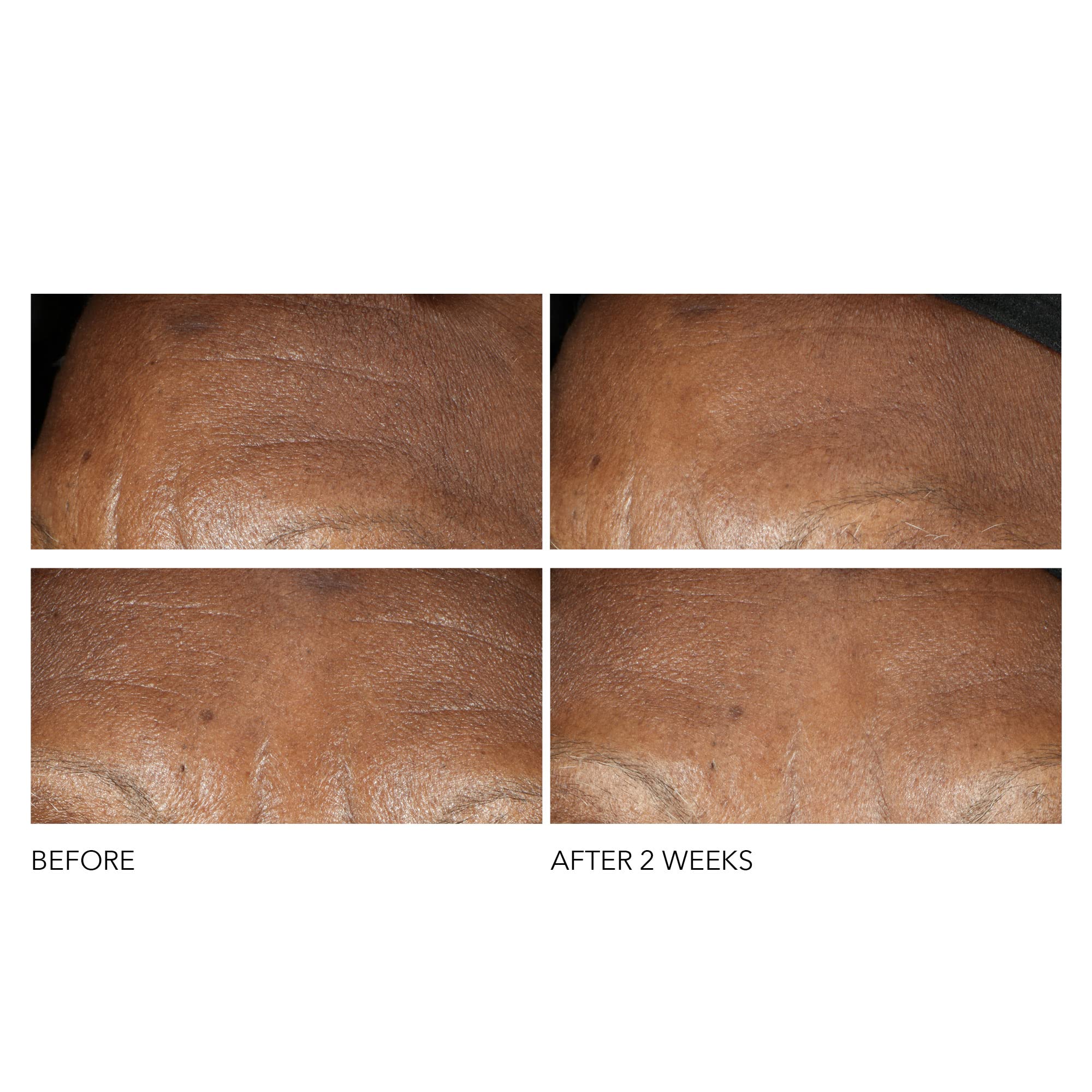 Dr Dennis Gross Advanced Retinol + Ferulic Intense Wrinkle Cream | Intensely Hydrating to Visibly Transform Skin and Repair the Moisture Barrier | 2 oz Dr Dennis Gross buy supplements canada