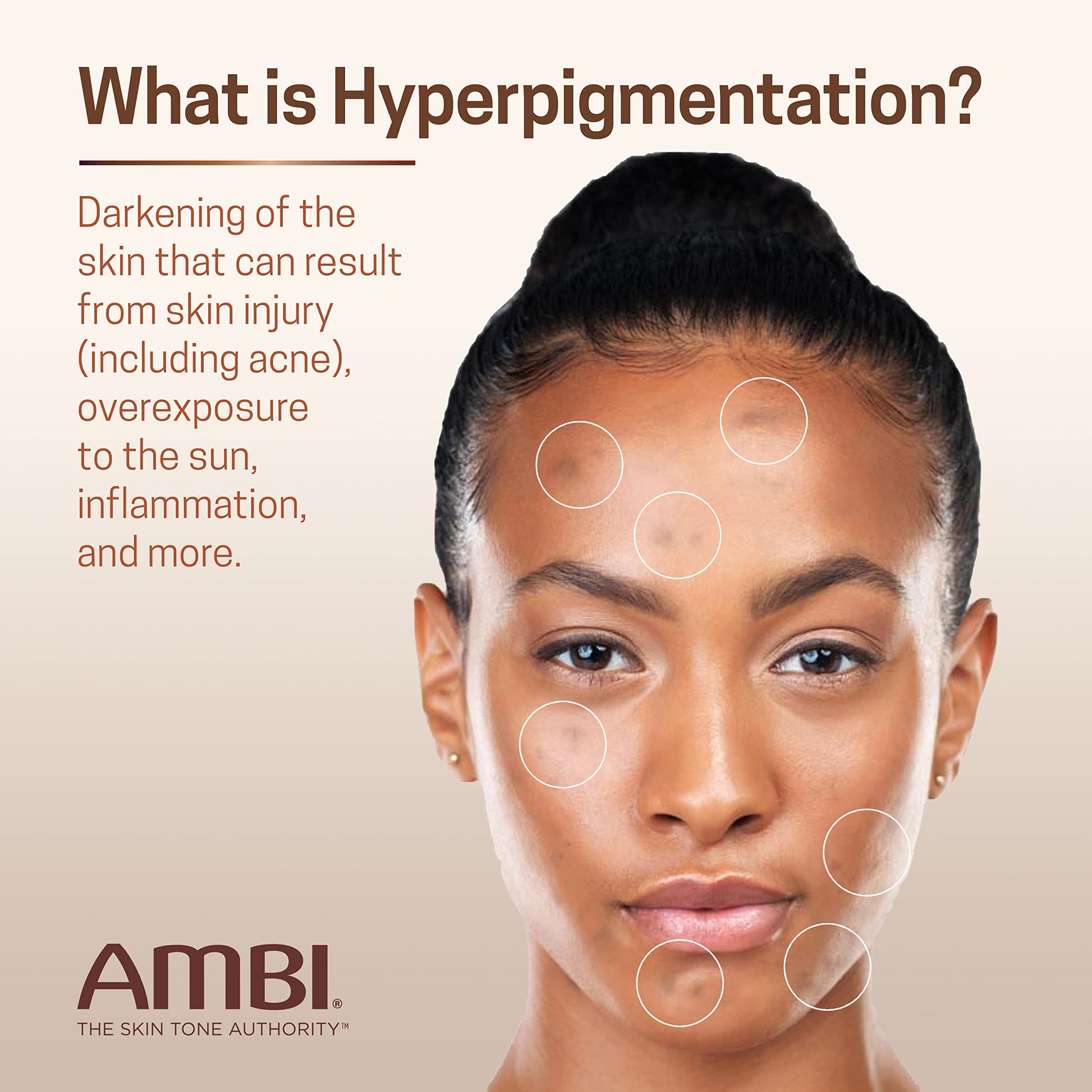 Ambi Even & Clear Advanced Fade Cream, Hydroquinone-free, Hyperpigmentation Treatment, Stubborn Dark Spot Corrector, Results In As Little As 2-3 Weeks Ambi buy supplements canada