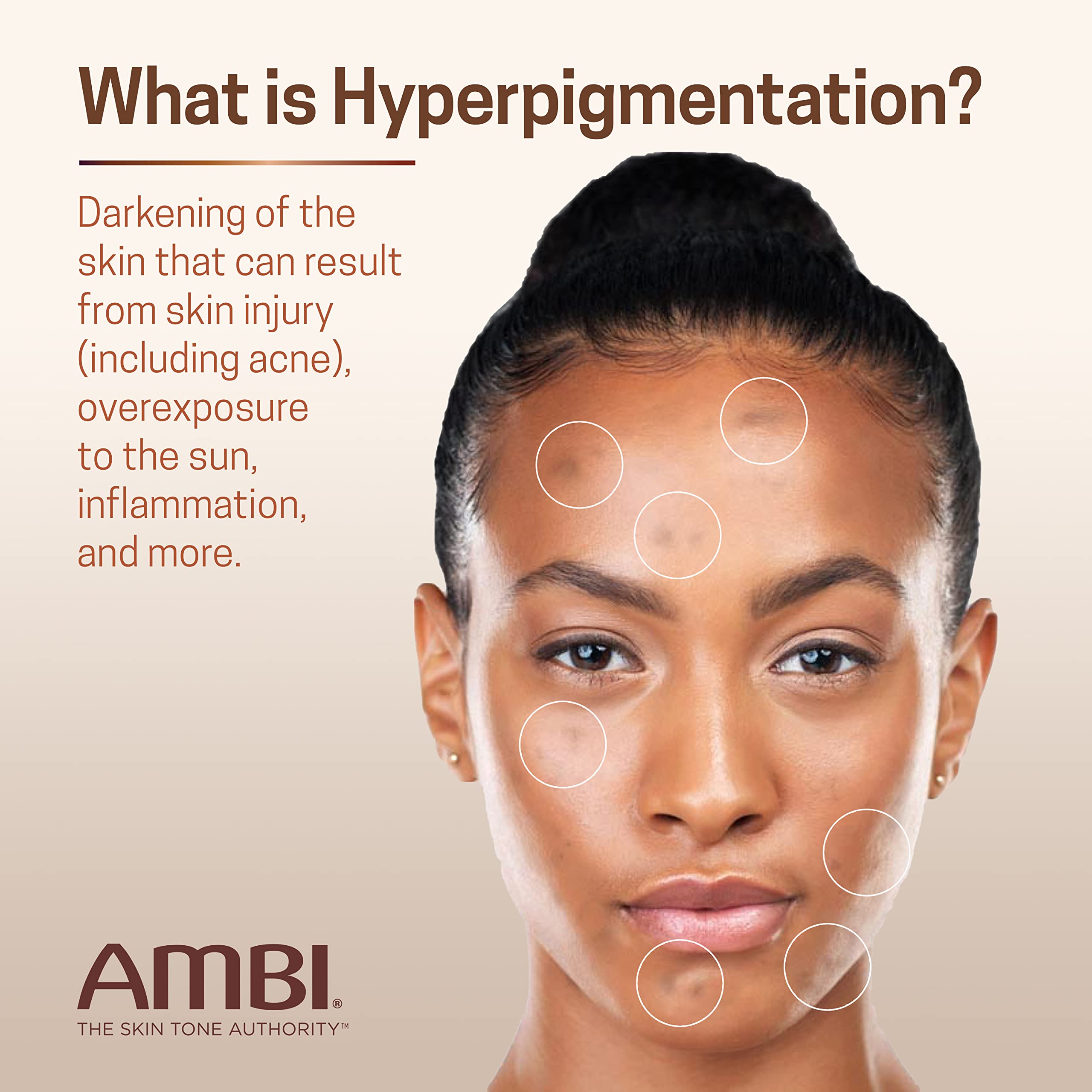 Ambi Even & Clear Advanced Fade Cream, Hydroquinone-free, Hyperpigmentation Treatment, Stubborn Dark Spot Corrector, Results In As Little As 2-3 Weeks Ambi buy supplements canada