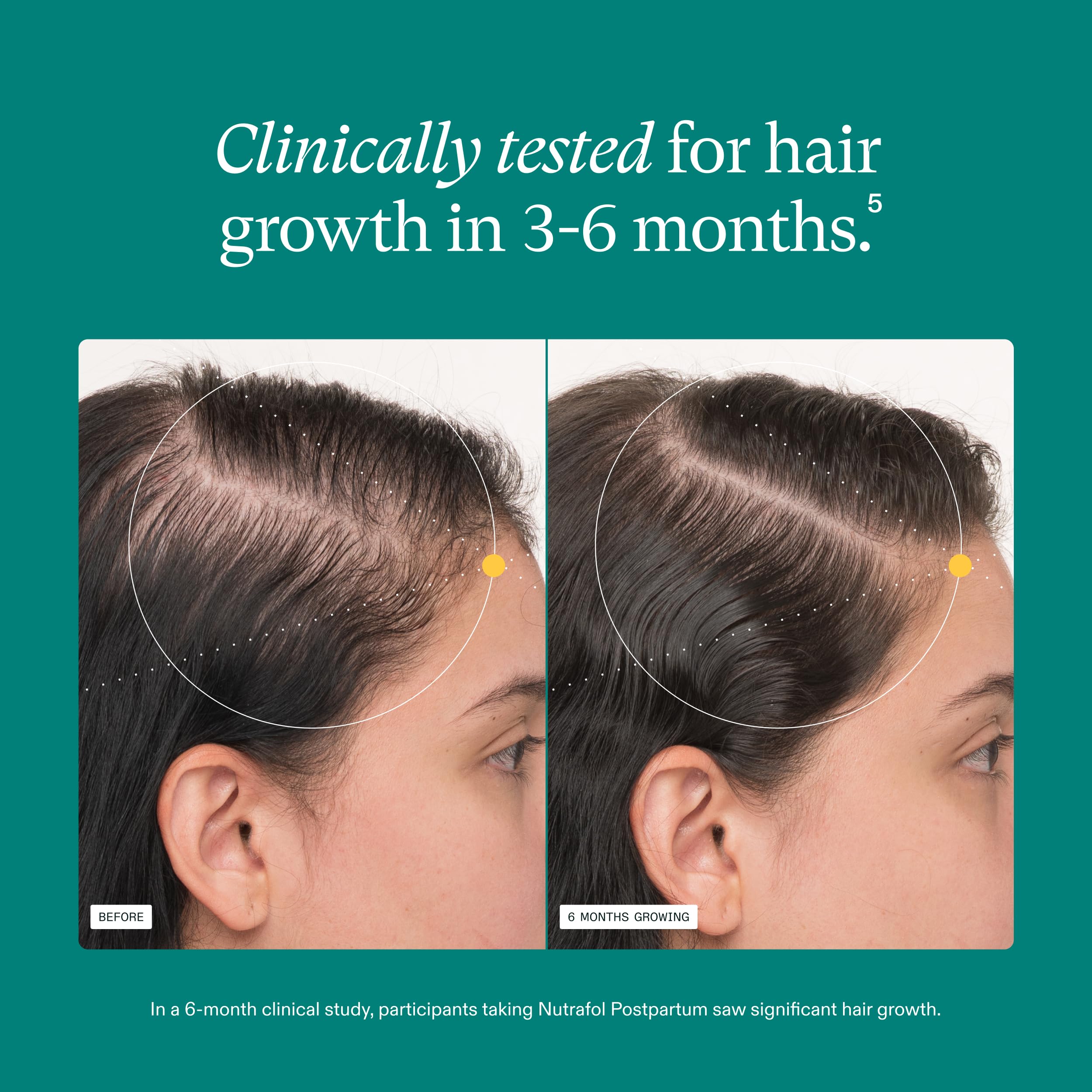 Nutrafol Postpartum Hair Growth Supplements, Clinically Tested for Visibly Thicker Hair and Less Shedding, Breastfeeding-friendly - 1 Month Supply Nutrafol buy supplements canada