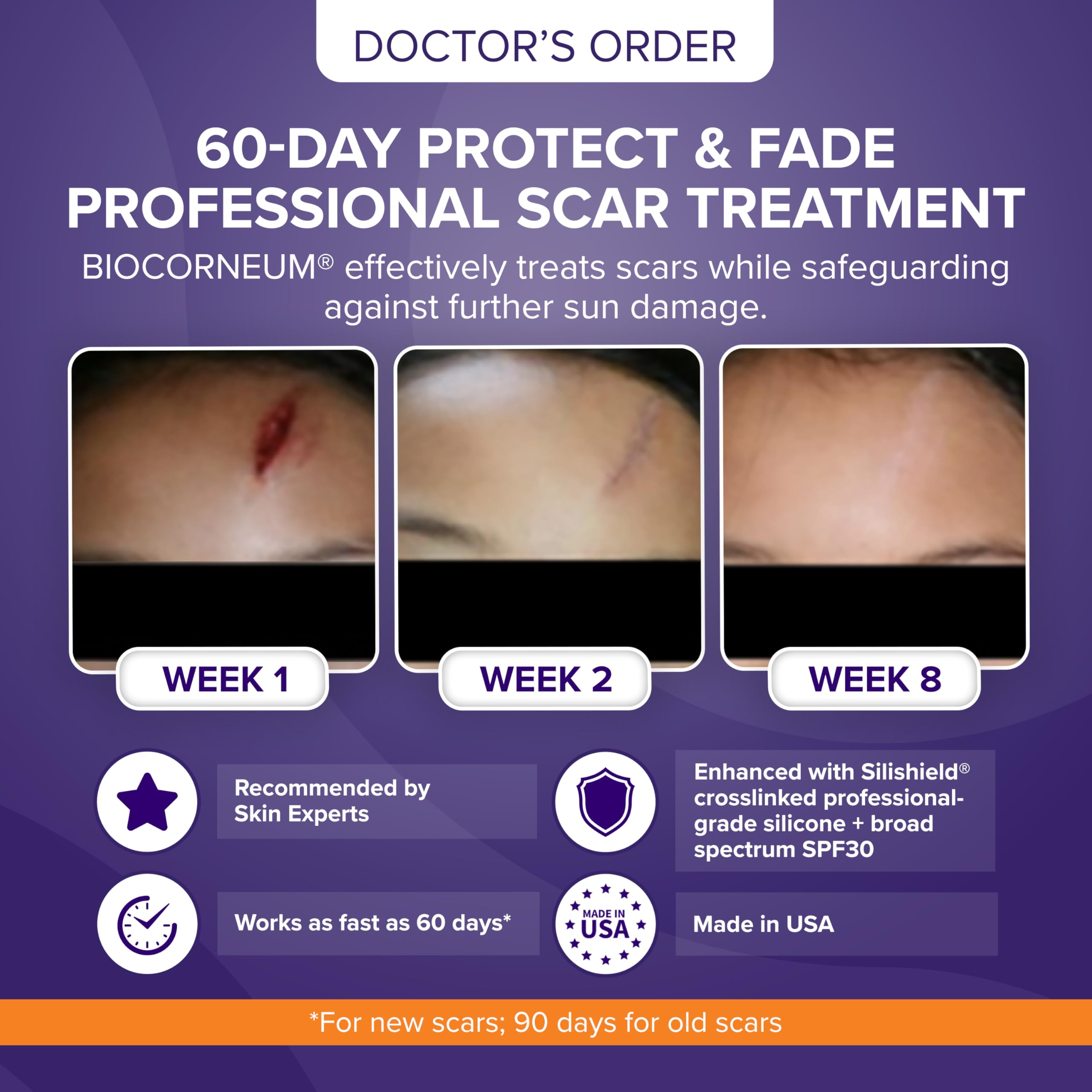 Biocorneum Advanced Scar Treatment with Silishield® & SPF 30 10g – Medical Grade Silicone Gel to Support Healing of Surgical Scars and Marks BIOCORNEUM buy supplements canada