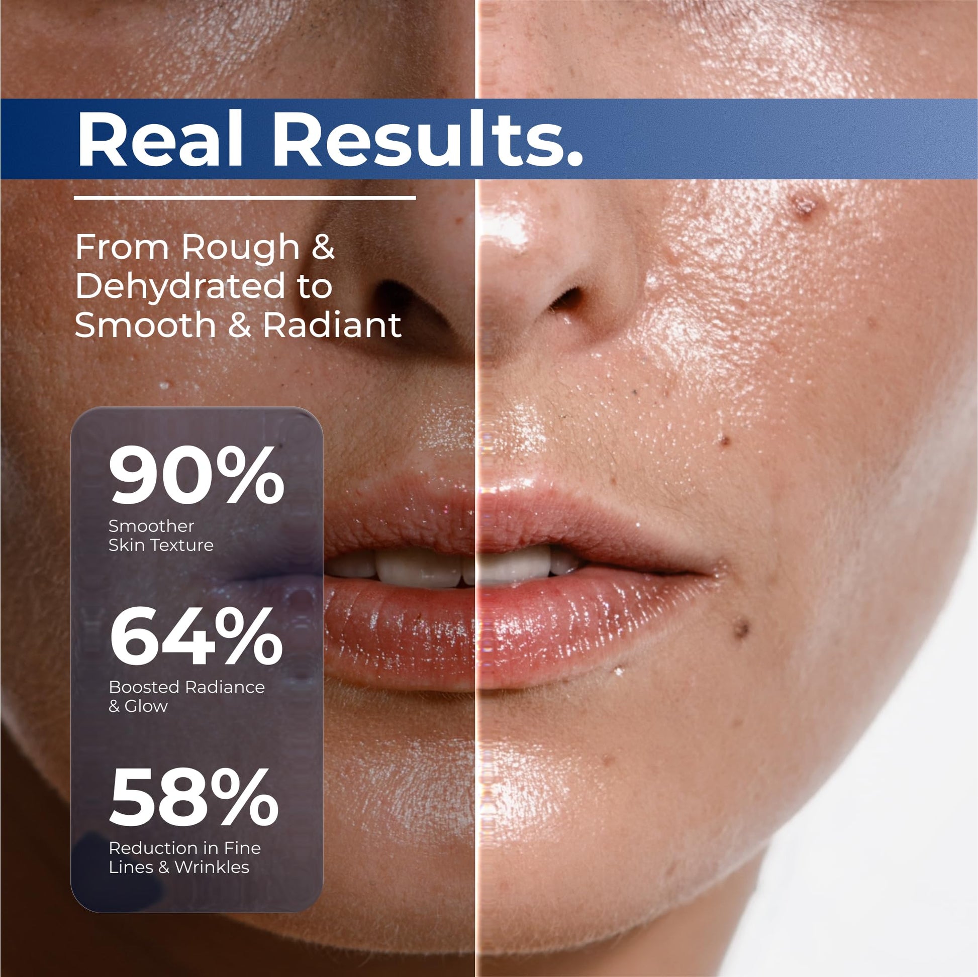 TURMSKIN® Hyaluronic Acid Serum Ampoules [ULTRA HYDRATING VIALS] - 3% Hyaluron Booster for Glass Skin & Anti Aging - 24 Hours Hydration Turmskin buy supplements canada
