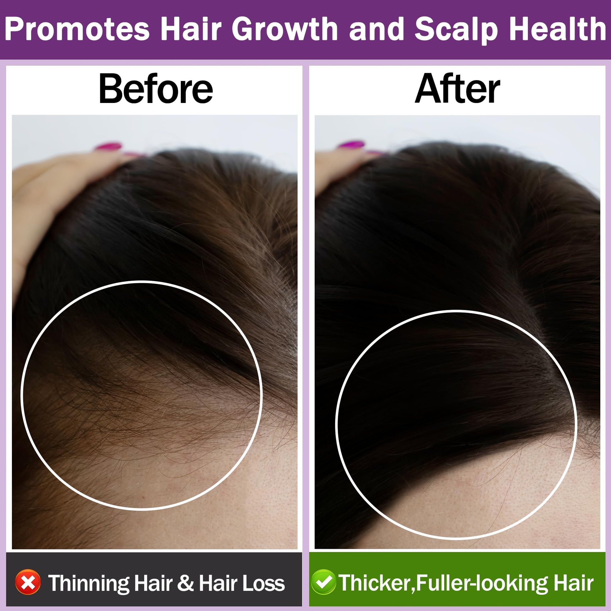 Rosemary Oil for Hair Growth,100% Pure Undiluted Light-Weight Non-Greasy Rosemary Essential Oil GIFBEA buy supplements canada