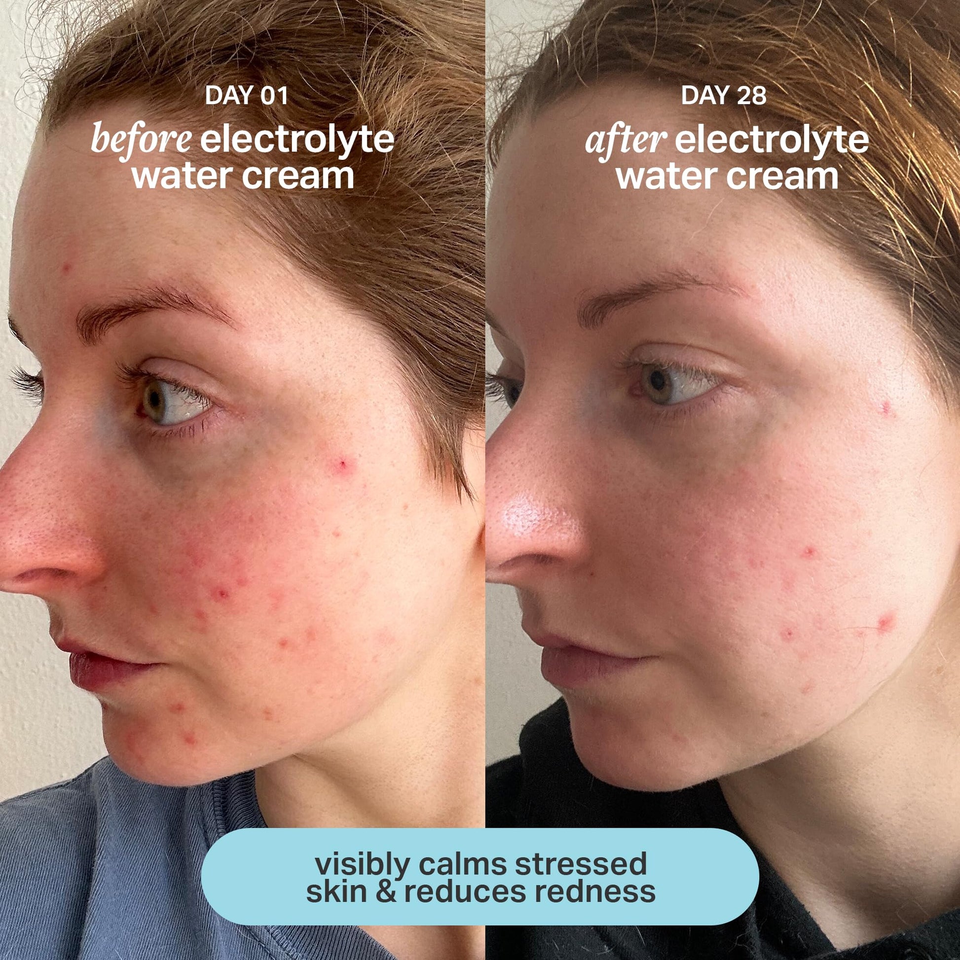 Cocokind Electrolyte Water Cream | Lightweight Water Gel Moisturizer | Balanced Hydrating Day Cream for All Skin Types | 1.7 Fl Oz Cocokind buy supplements canada