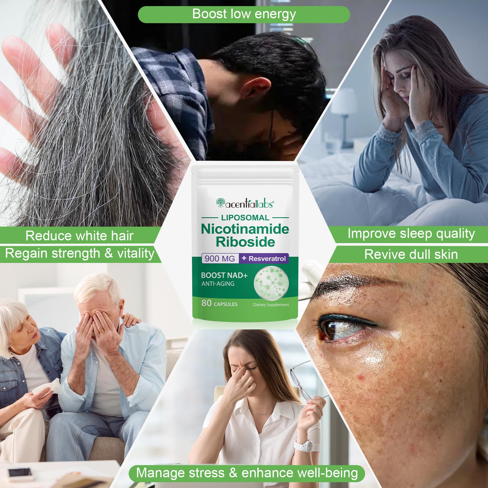 XINSZLIN NAD Supplement, NAD+ Nicotinamide Riboside Resveratrol 900mg, Dietary Supplement for Healthy Cellular Function, NAD+ Fuels Cellular Defense and Cctivates Anti-Aging Genes 80 Capsules XINSZLIN buy supplements canada