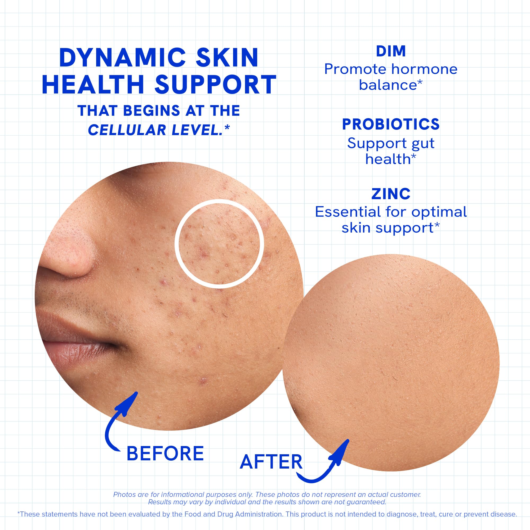 Clear Skin Supplement with Zinc, DIM & Probiotics | 3-in-1 Balance, Glow & Health Skin Support | Triple Action Hyaluronic Acid, Niaciminide & Vitamins for Hormone, Complexion & Gut Support | 180 Ct SMNutrition buy supplements canada