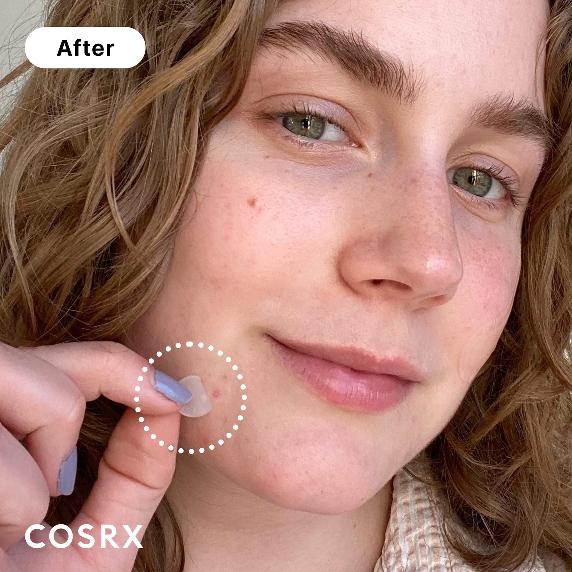COSRX Acne Pimple Patch (96) Absorbing Hydrocolloid Original 3 Size Patches for Blemishes and Zits Cover COSRX buy supplements canada