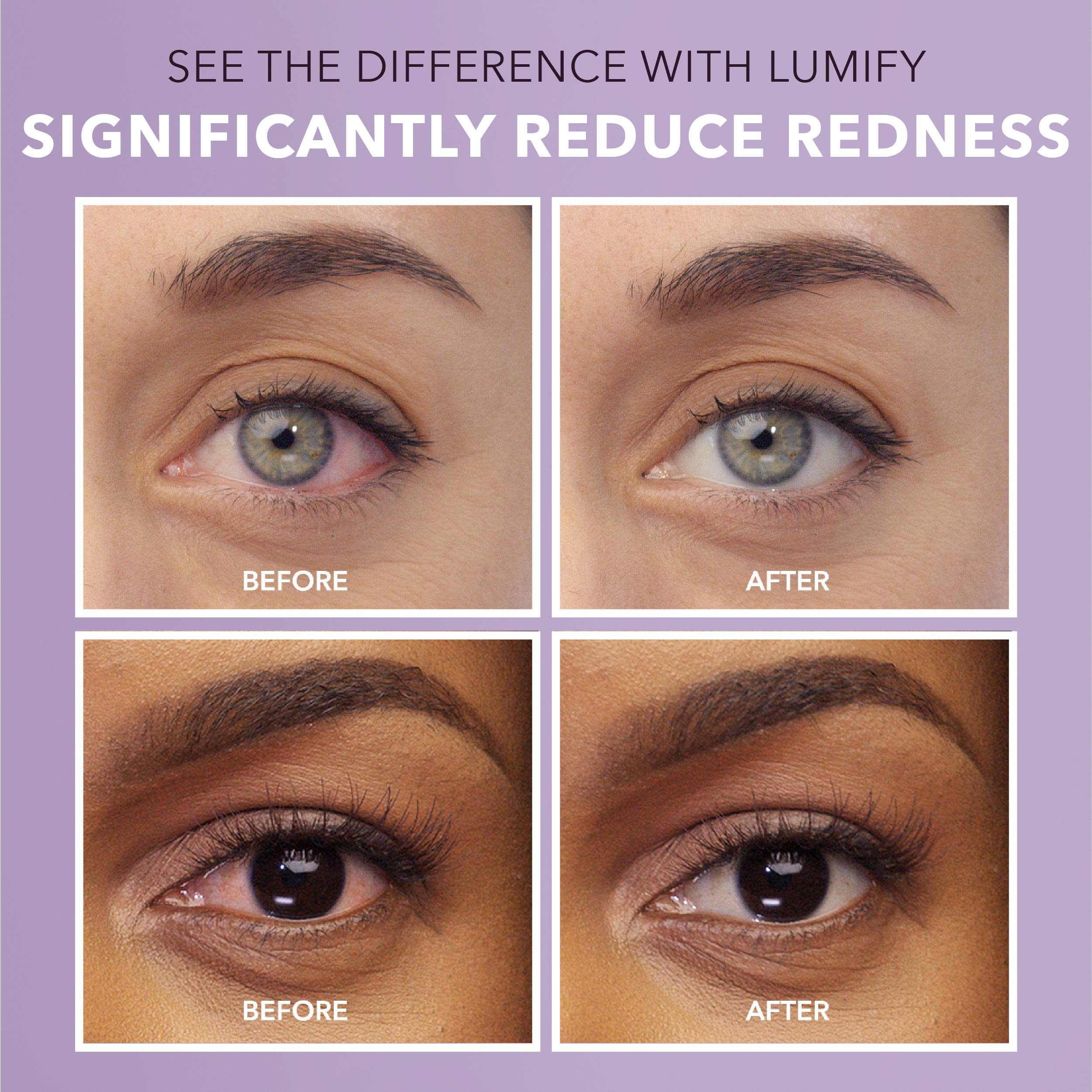 LUMIFY Eye Drops for Red Eyes, Redness Reliever for Brighter Looking Eyes, Works in 1 Minute & Lasts Up to 8 Hours, Eye Drops, 0.25 Fl Oz (7.5mL) LUMIFY buy supplements canada