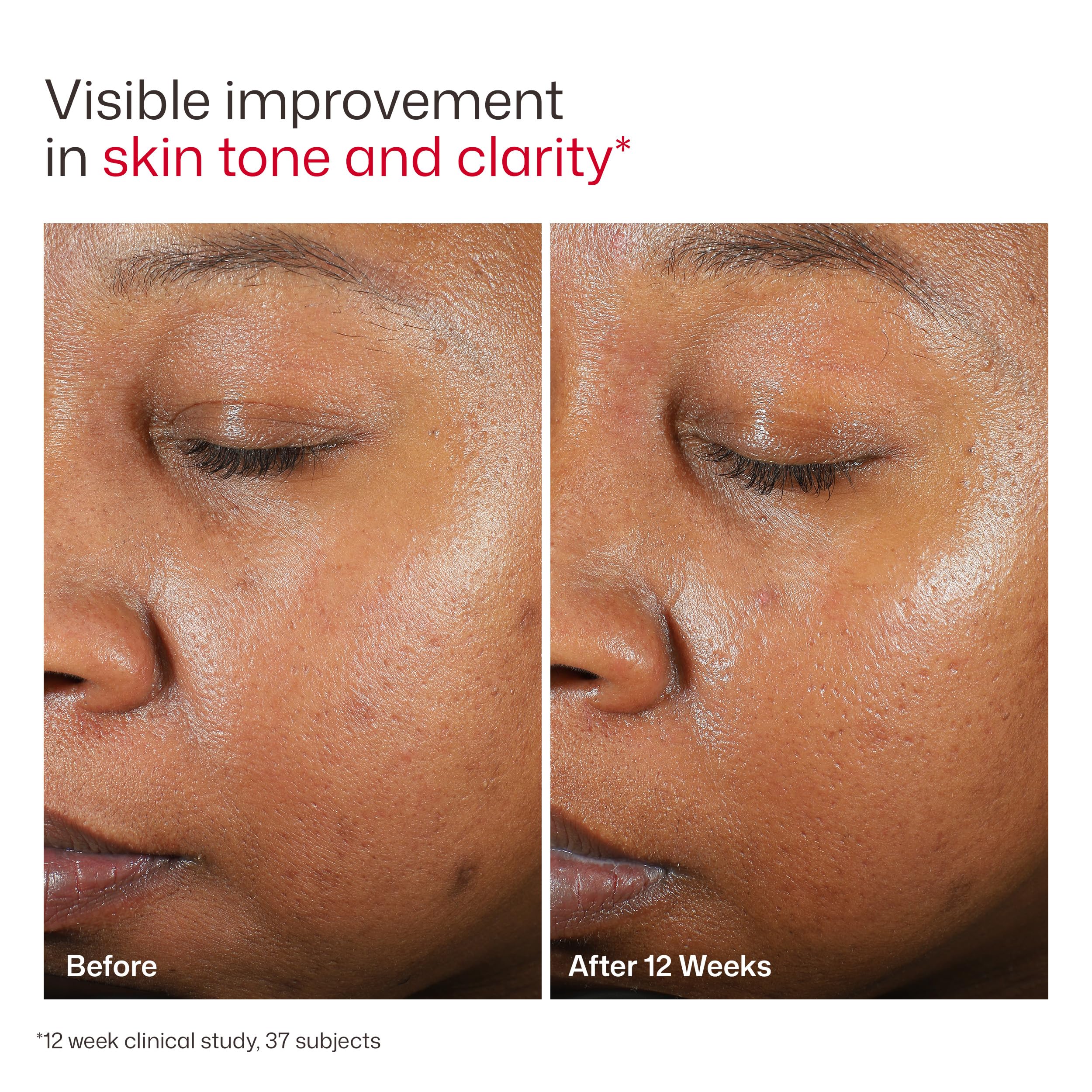 EltaMD UV Clear Tinted Sunscreen for Face, SPF 46 with Zinc Oxide, Oil-Free, Dermatologist Recommended, For Acne-Prone Sensitive Skin, 1.7 oz EltaMD buy supplements canada