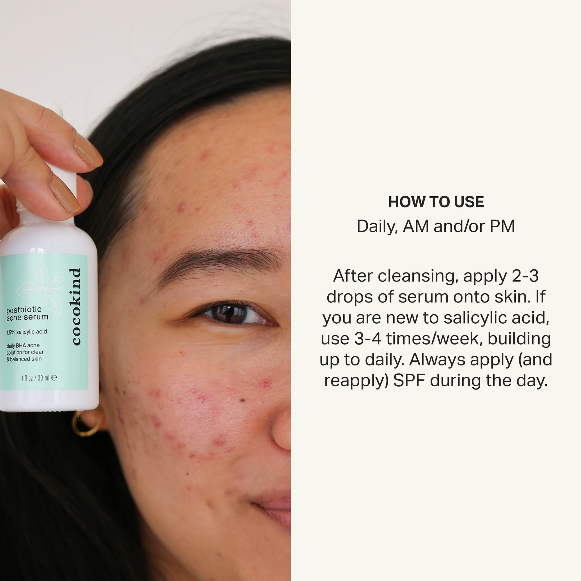 Cocokind Postbiotic Acne Serum, Salicylic Acid Serum and BHA Liquid Exfoliant - Exfoliating, Brightening and Hydrating Serum - OzHealthStandard
