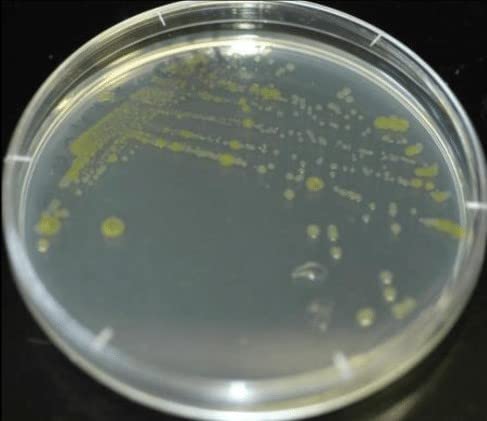 Diamante Scientific Essential Bacteria Kit. Pre-Poured Agar Plates & Swabs. Perfect for Kids. Great for Learning About Microbiology. STEM Education. Experiment Guide eBook Included! - OzHealthStandard