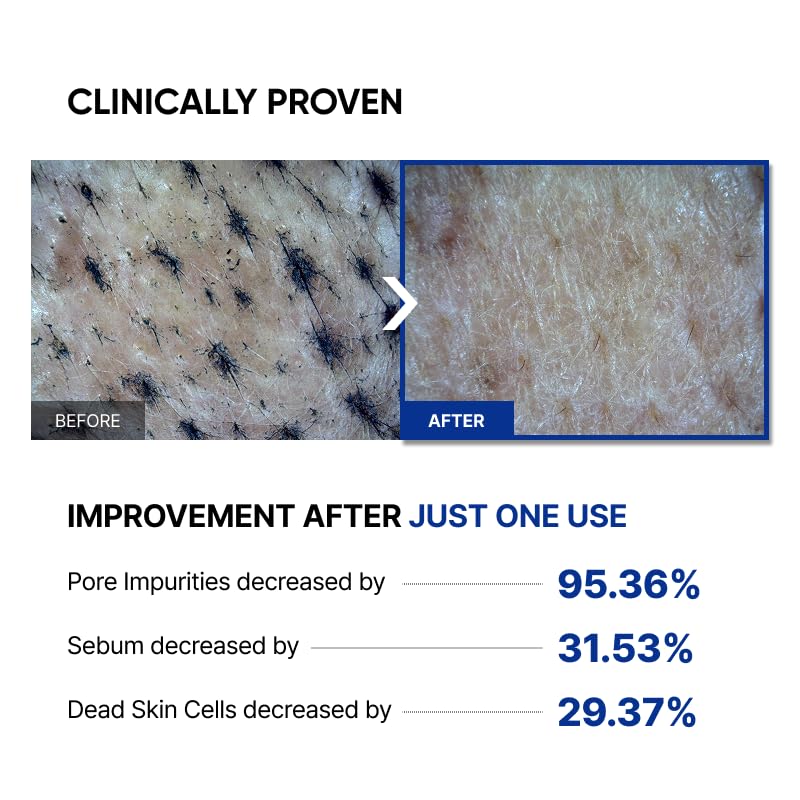 SAYNID MICROBIOME RENEWING CREAM MASK TRIAL KIT, Wash-off Cream, Soft Exfoliating Face Scrub Dead Skin Cells | 4.5g/0.15oz (3EA) - OzHealthStandard